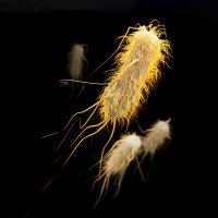 Bildet viser ESBL (extended-spectrum beta-lactamase).