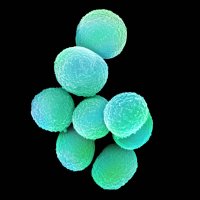 Bildet viser MRSA (meticillinresistente gule stafylokokker).