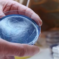 Bildet viser en petriskål med Pseudomonas aeruginosa.