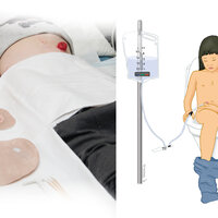 Bildet viser ei jente med kolostomi. På stellebordet ligger pose og annet utstyr. Illustrasjonen viser et barn med blindtarmsstomi som sitter på toalettet og skyller tarmen med skyllepose og kateter inne i stomien.