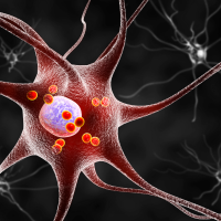 Grafisk illustrasjon av Parkinson-nerveceller